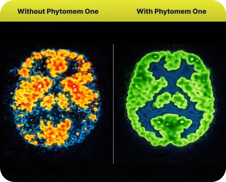 Brand graphic of two colored brain scans labeled Without Phytomem One and With Phytomem One